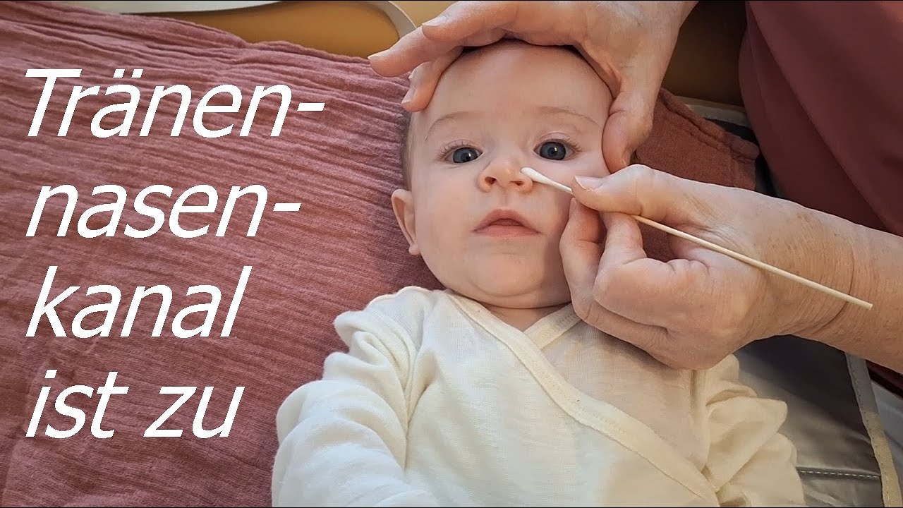 Tränennasenkanal und die verstopfte Nase einfach befreien.