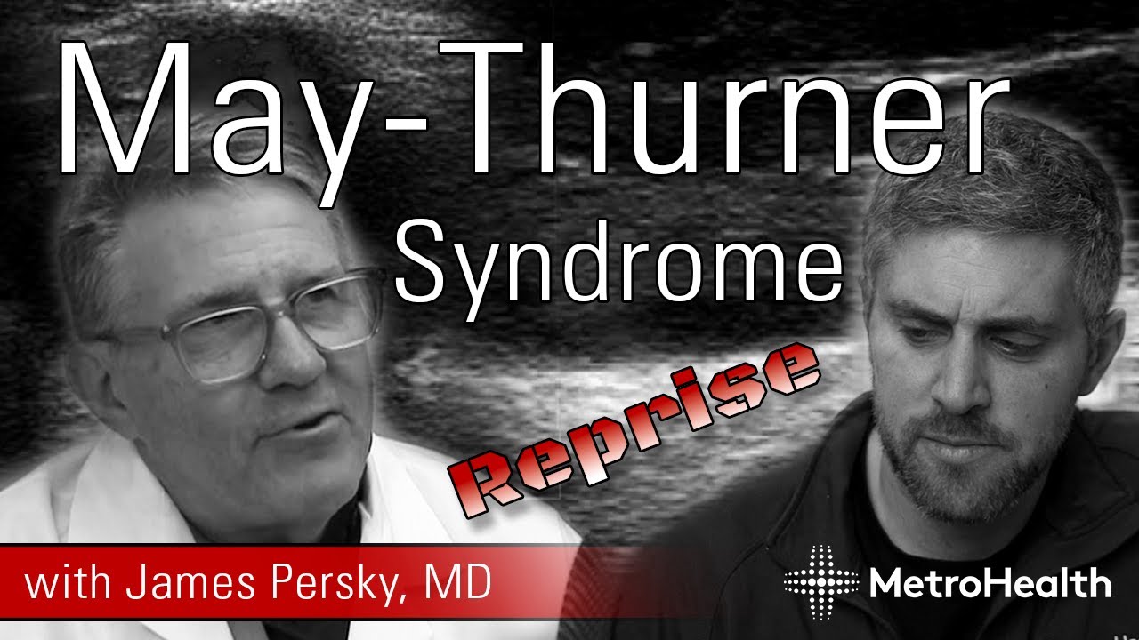 May-Thurner Syndrome Reprise w/ James Persky, MD