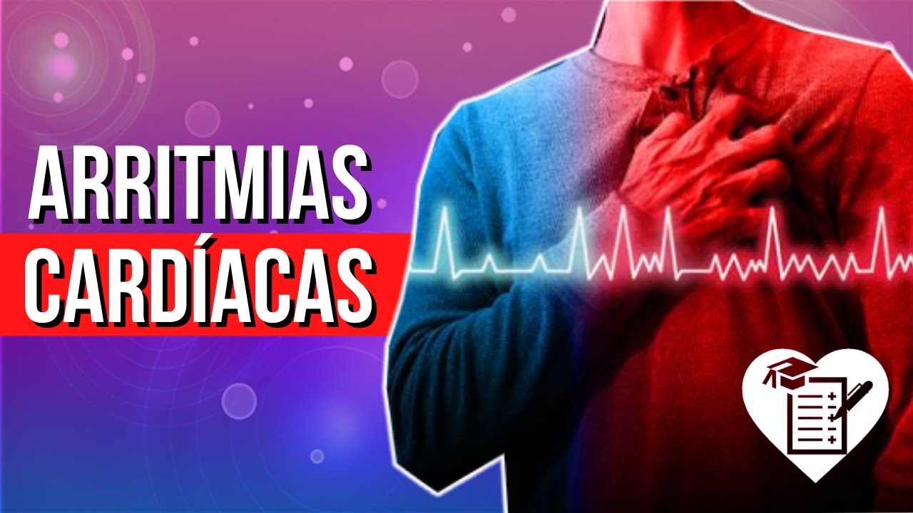 ARRITMIAS CARDÍACAS | Sinais, Sintomas, Diagnóstico e Tratamento