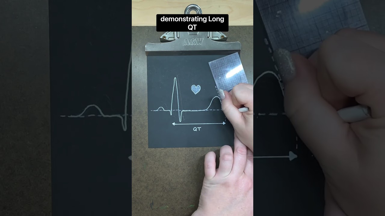 Disability Alphabet E is for EKG #Disability #DisabilityAwareness #Art #Drawing #ChronicIllness