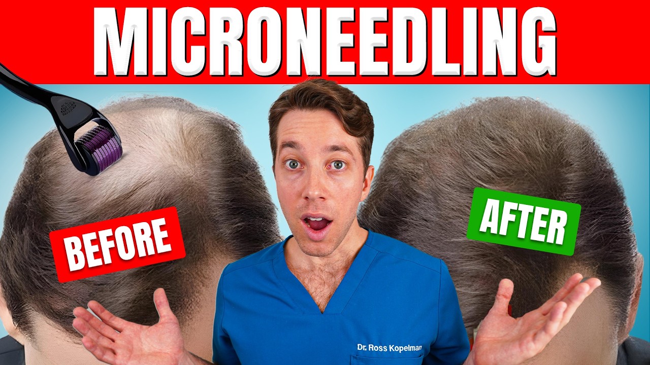 Does Microneedling Actually Regrow Hair? | Hair Surgeon's Advice