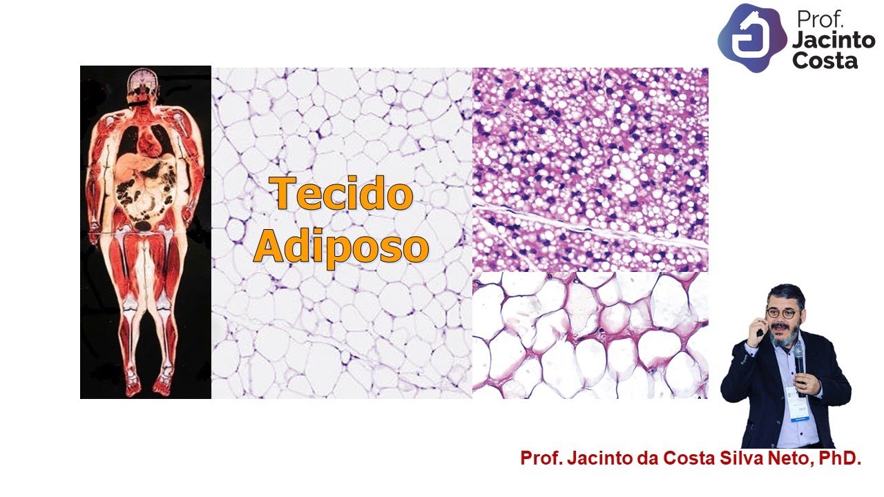 11-Tecido Adiposo - N&iacute;vel Gradua&ccedil;&atilde;o