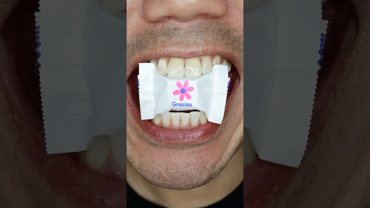 Gracias 🌸| Ritter SPORT Cubes Thank You Chocolate 🍫 #DoctorTristanPeh #ASMR #shorts