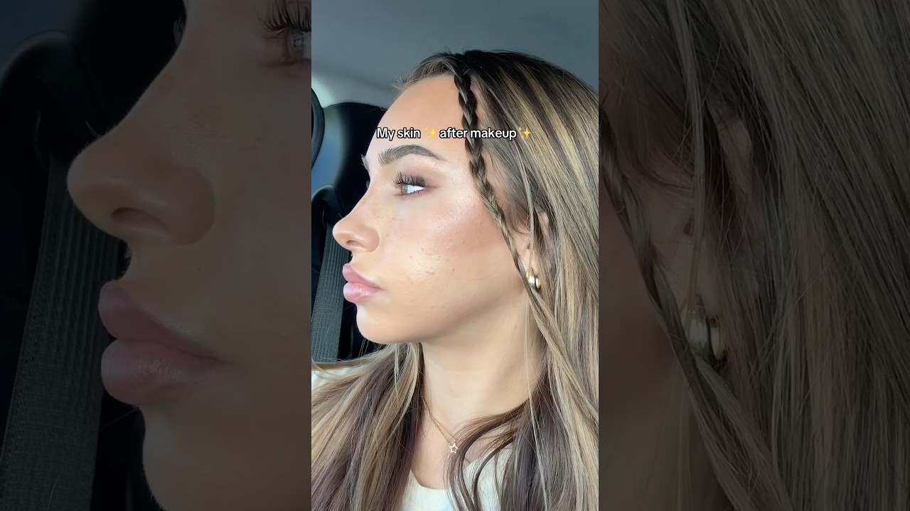 Skin before vs after makeup #makeup #skincare #acne #girls #relatable