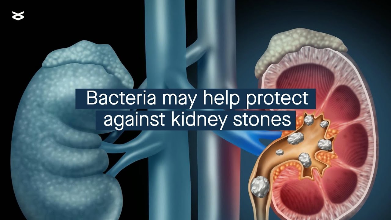 How Lactobacillus acidophilus might protect against kidney stones