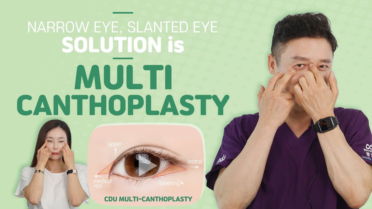 How to Make Cat Eye: Multi Canthoplasty