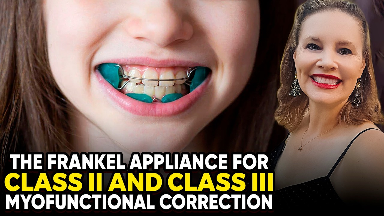 The Frankel Appliance for Class II and Class III Bites