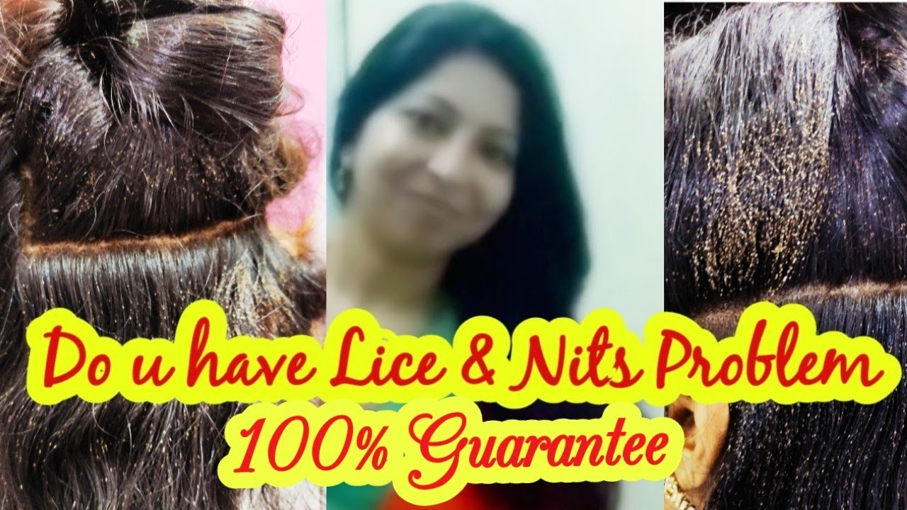 Lice And Nits Treatment