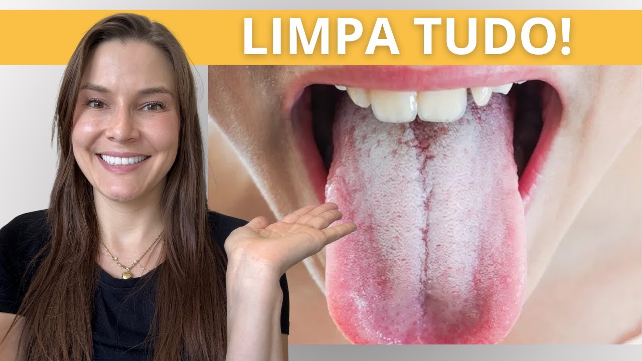 Língua BRANCA mesmo escovando? Dentista ensina 