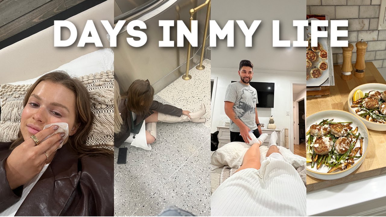 VLOG: fracturing my ankle, fancy fries & cutting my hair even shorter
