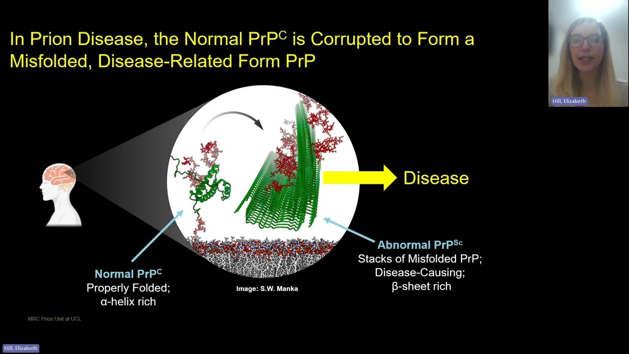 Elizabeth (Lizzie) Hill - Introduction to Prion Disease