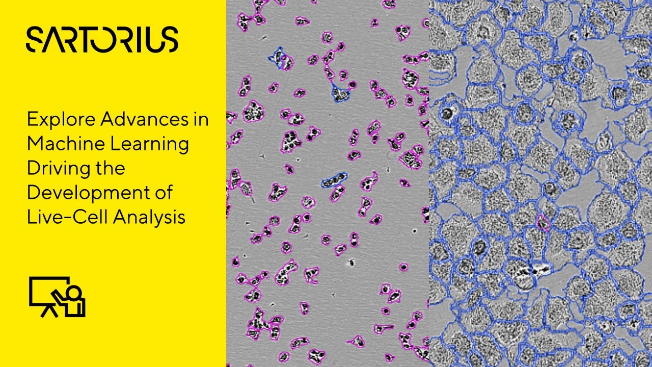 Conference Presentation: Quantifying Morphological Change Using Label-Free Live-Cell Analysis