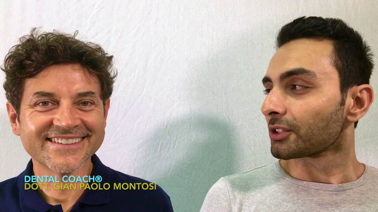 Le interviste del Dental Coach&reg; - LE FACCETTE di Max -