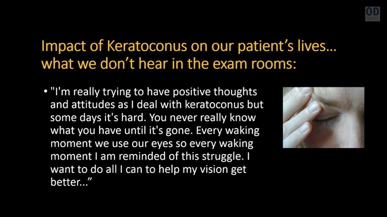 Keratoconus: Early Screening to Advanced Management