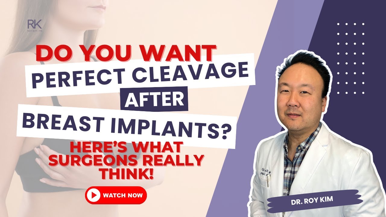 Want Perfect Cleavage After Implants? Here's What Surgeons Really Think! | Dr. Roy Kim