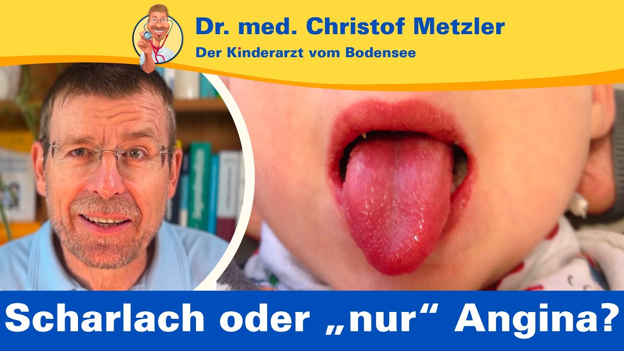 Scharlach erkennen, was Sie wissen sollten! – Der Kinderarzt vom Bodensee
