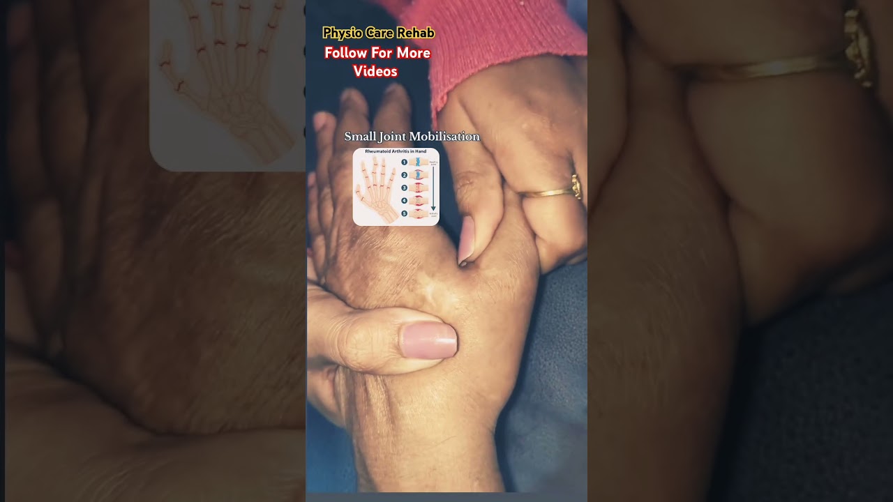 Small Joints Mobilization & Rheumatoid arthritis in Hand ✅️ Subcribe For More Videos #share #follow