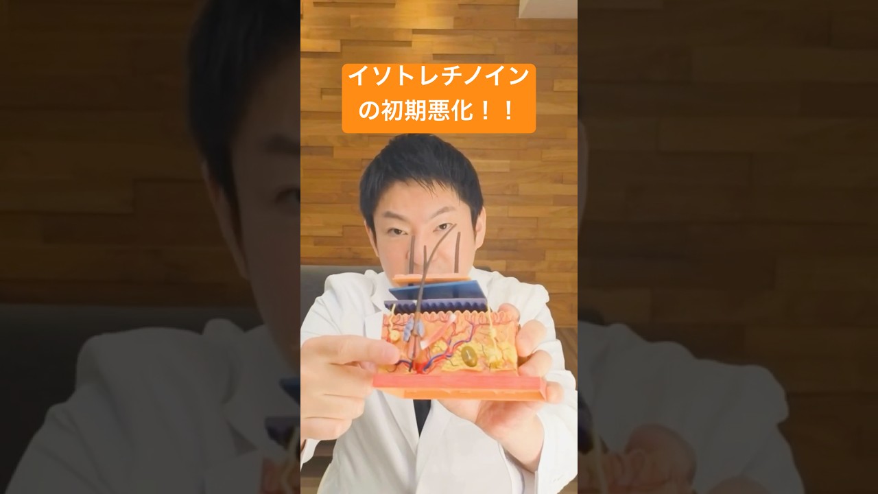 【好転反応】イソトレチノイン開始後にニキビが悪化⁉ それ、治る前の&ldquo;サイン&rdquo;かもしれません