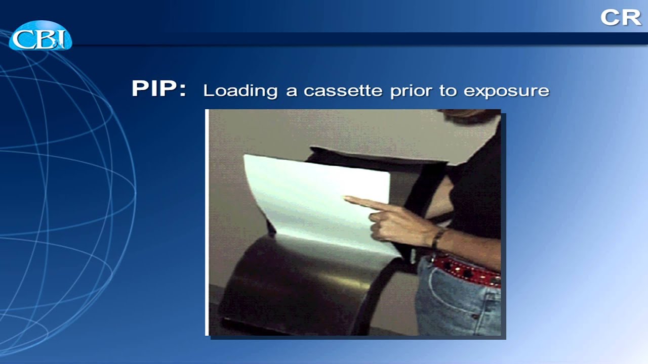 COMPUTED RADIOGRAPHY (CR)