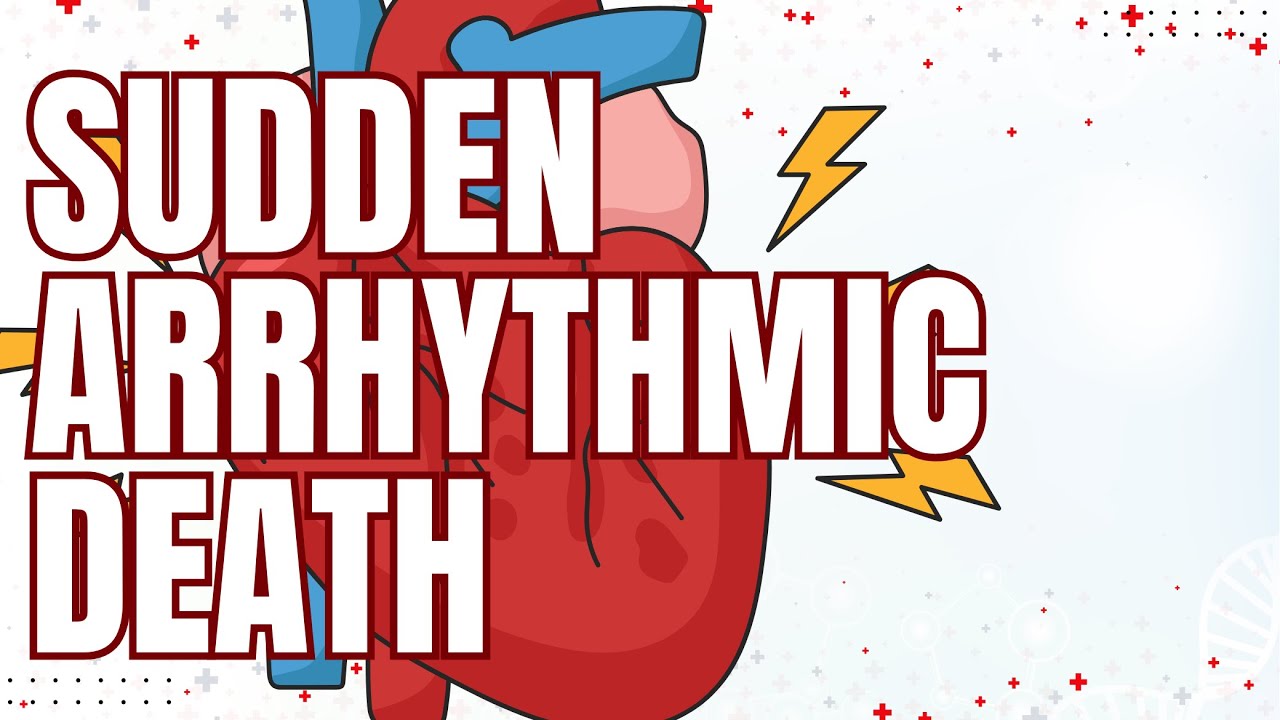 Sudden Arrhythmic Death Syndrome