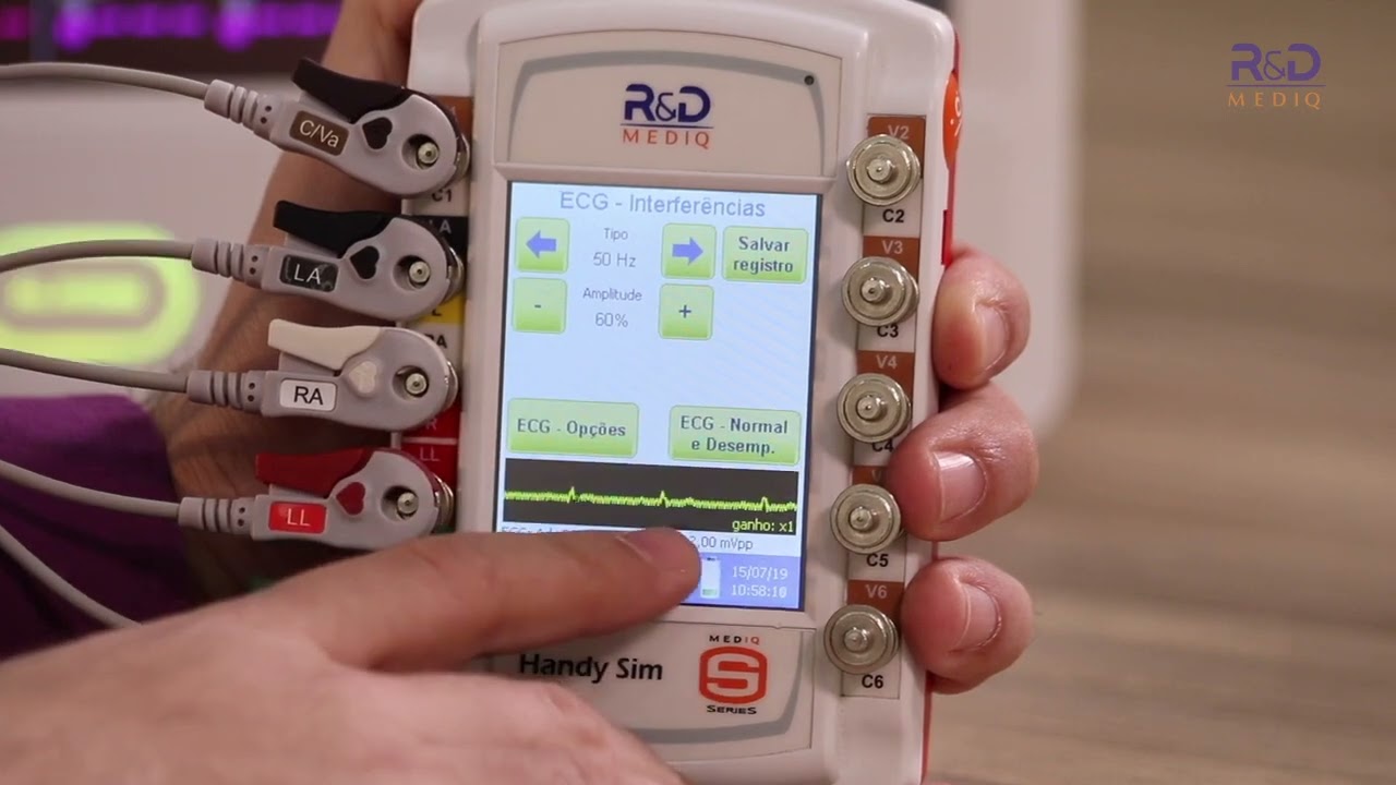 SIMULAÇÃO DE ECG UTILIZANDO O SIMULADOR HANDY SIM HS-30