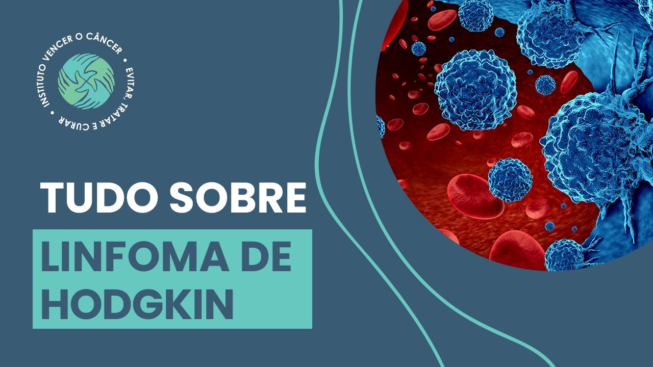 Linfoma de Hodgkin: O que &eacute;