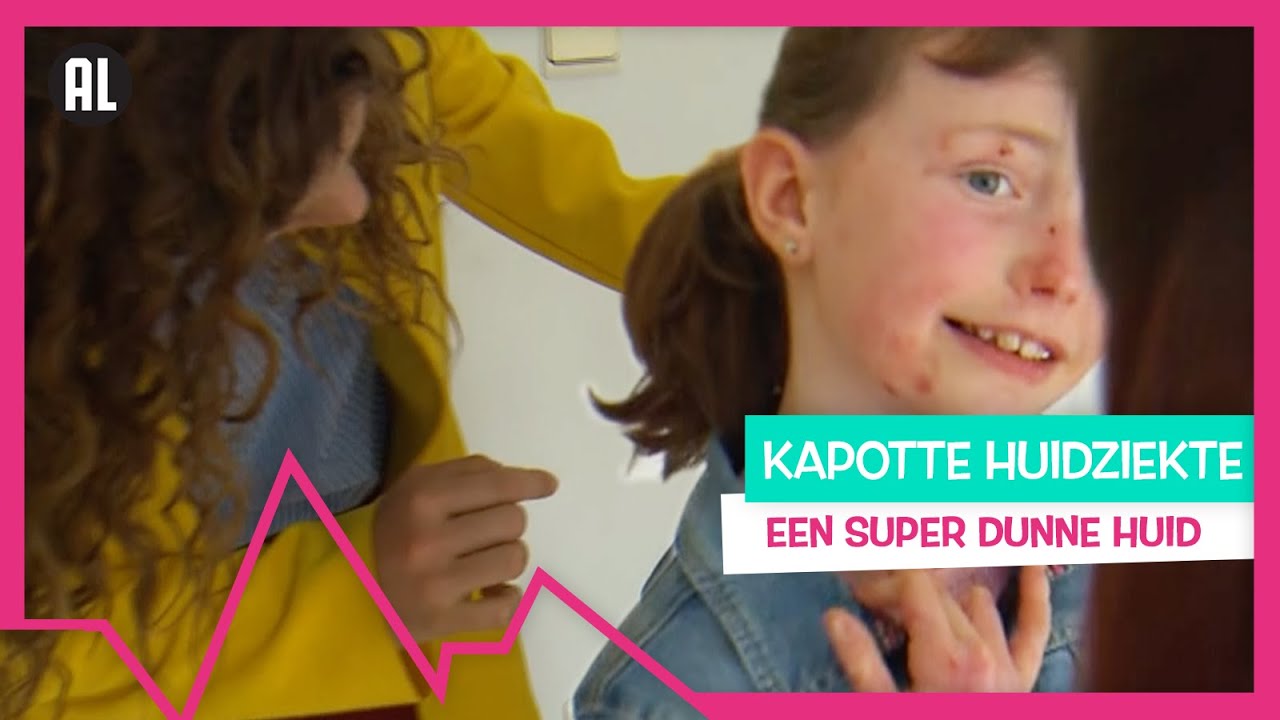 GEWOND DOOR KATTENHAAR?! - TOPDOKS NET FF ANDERS AMELIE