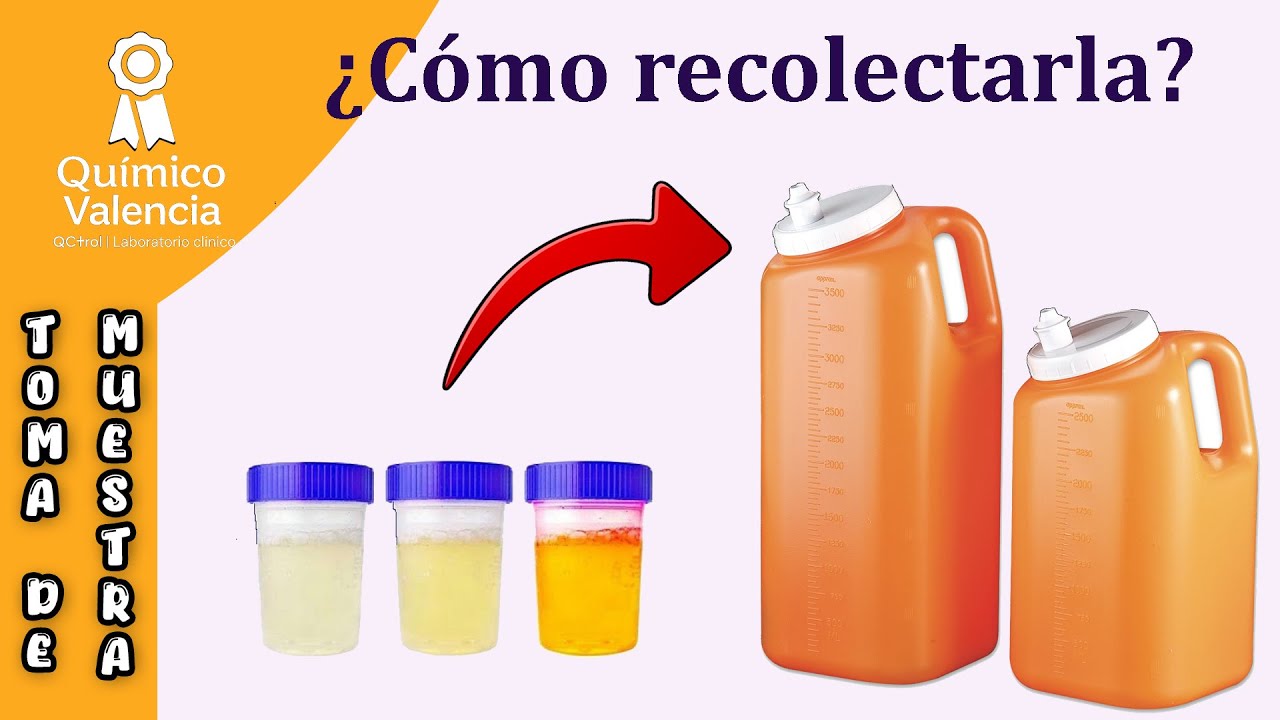Как собирается суточная моча?