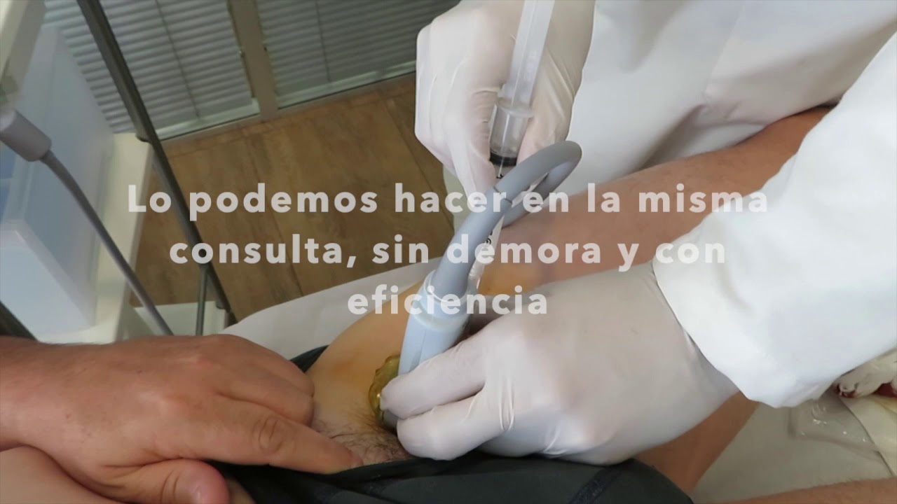 Terapia Ecoguiada Infiltracion Cadera, Hip ultrasound guided infiltration. #SportmeSevilla Bernáldez