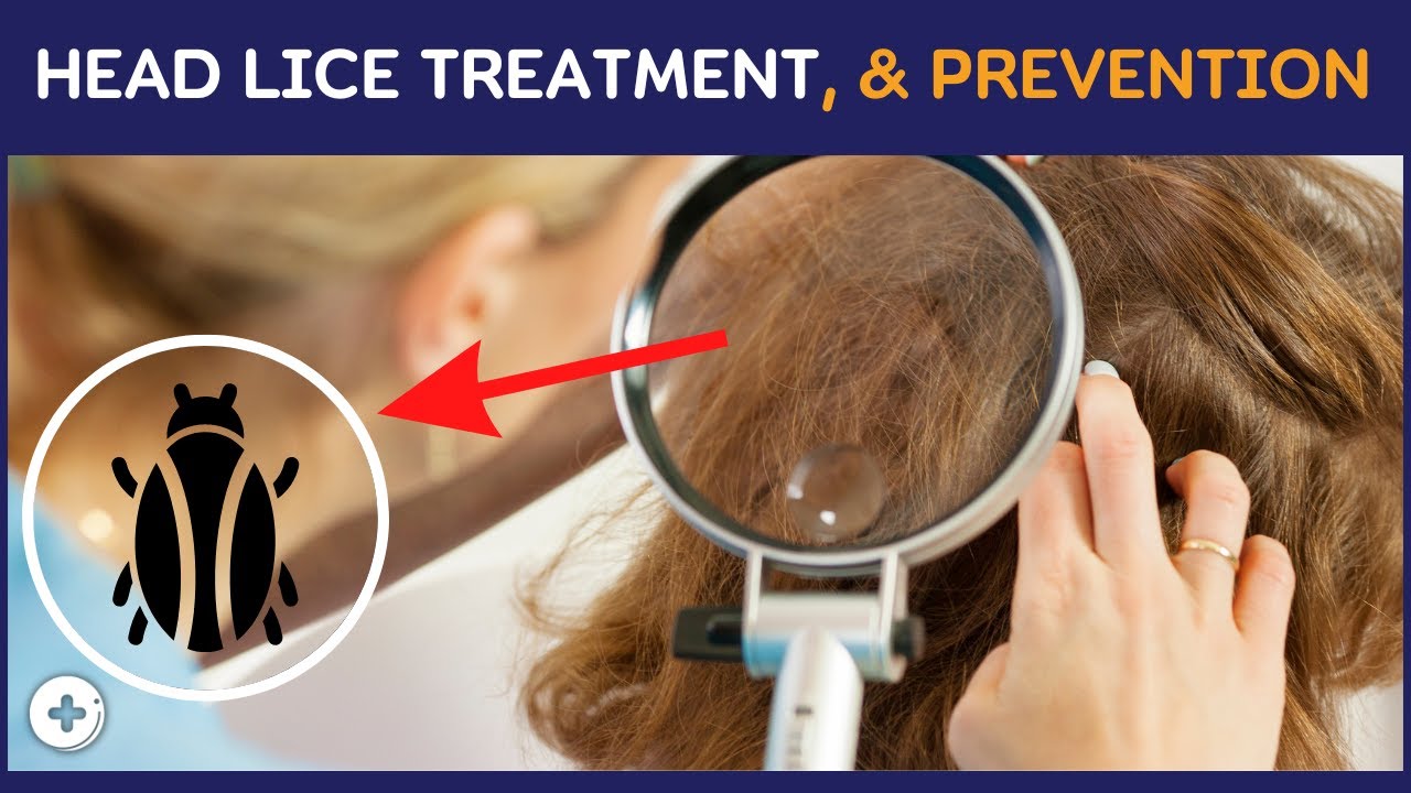 Head Lice: Life Cycle, Treatment, and Prevention | Health Guideline