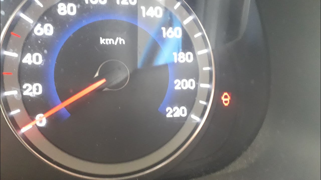 Hyundai Accent Blue Dizel Mazot filtre ışığı neden yanar