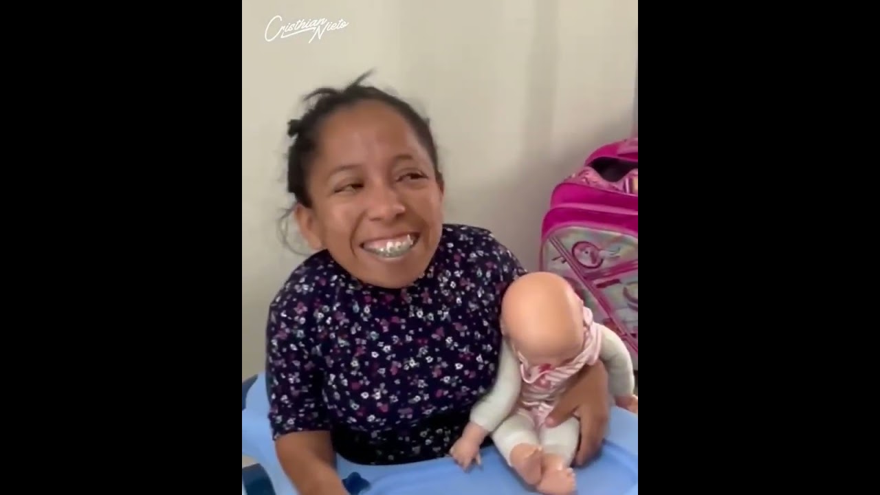 Así camina Mayito después de le que le pasó 😍