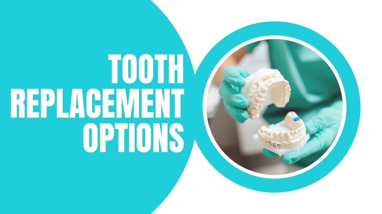 Before you replace missing teeth watch this! Tooth replacement options explained.