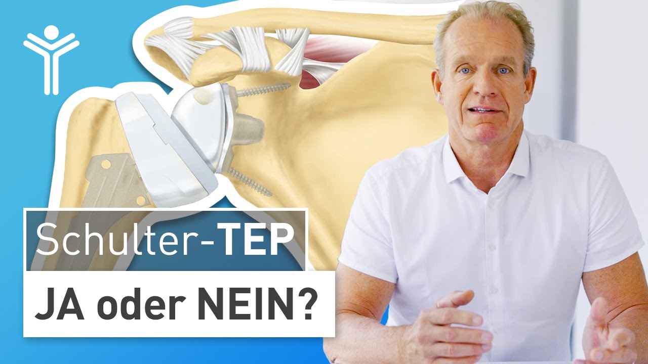 Schulterarthrose: Wann operieren? - Der richtige Zeitpunkt für ein künstliches Schultergelenk