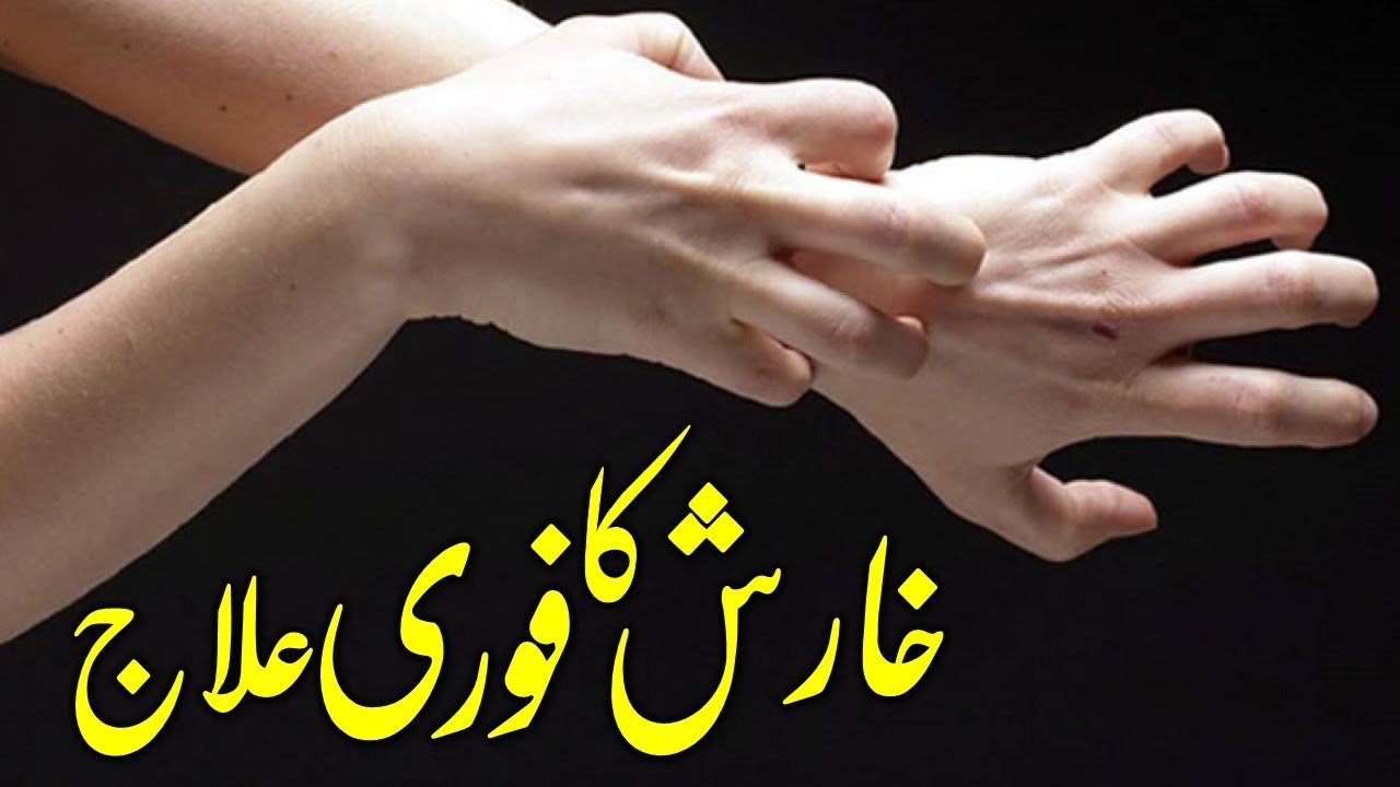 Kharish (Itching) Ka Fori Ilaj | Tibe Ahlebait (Part 26) | خارش | Maulana Syed Ali Naqi Kazmi