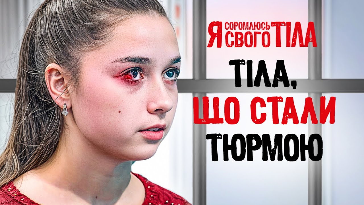 Опухоли на теле украли их будущее? – Я соромлюсь свого тіла | МЕДИЦИНА | ВРАЧИ | ЗДОРОВЬЕ