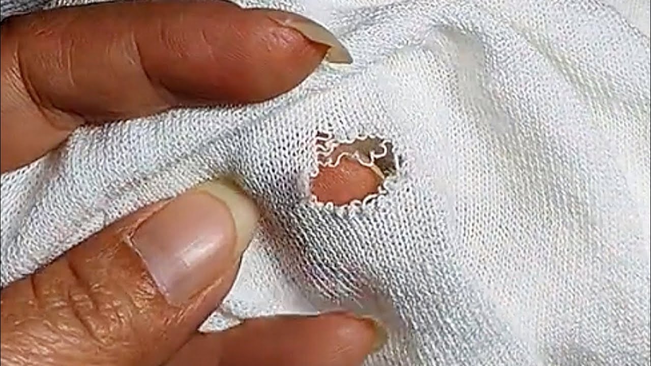 How to Perfectly Repair a Hole in a klKnitted Sweater