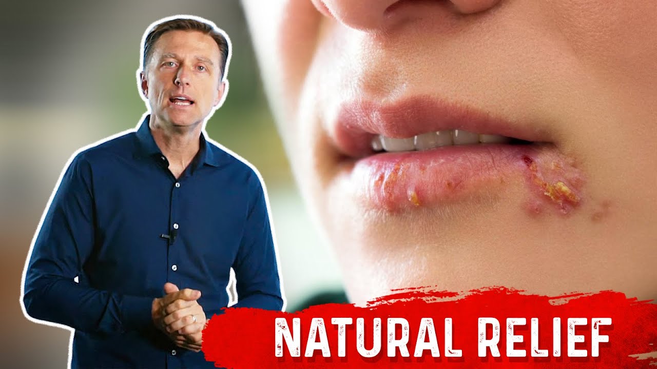 What is Herpes? &ndash; Types of Herpes & Remedies Covered by Dr.Berg