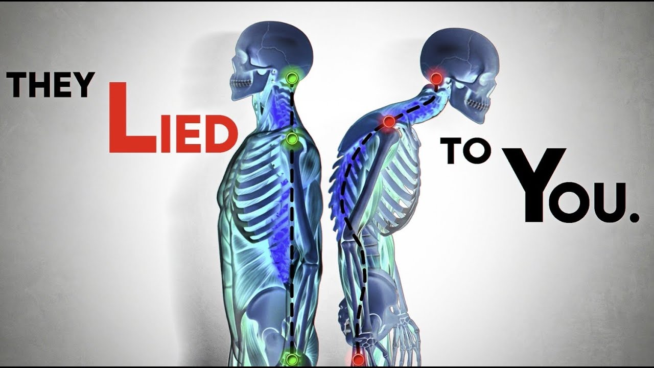 Why You Haven’t Fixed Your Posture - The #1 Lie You Believe