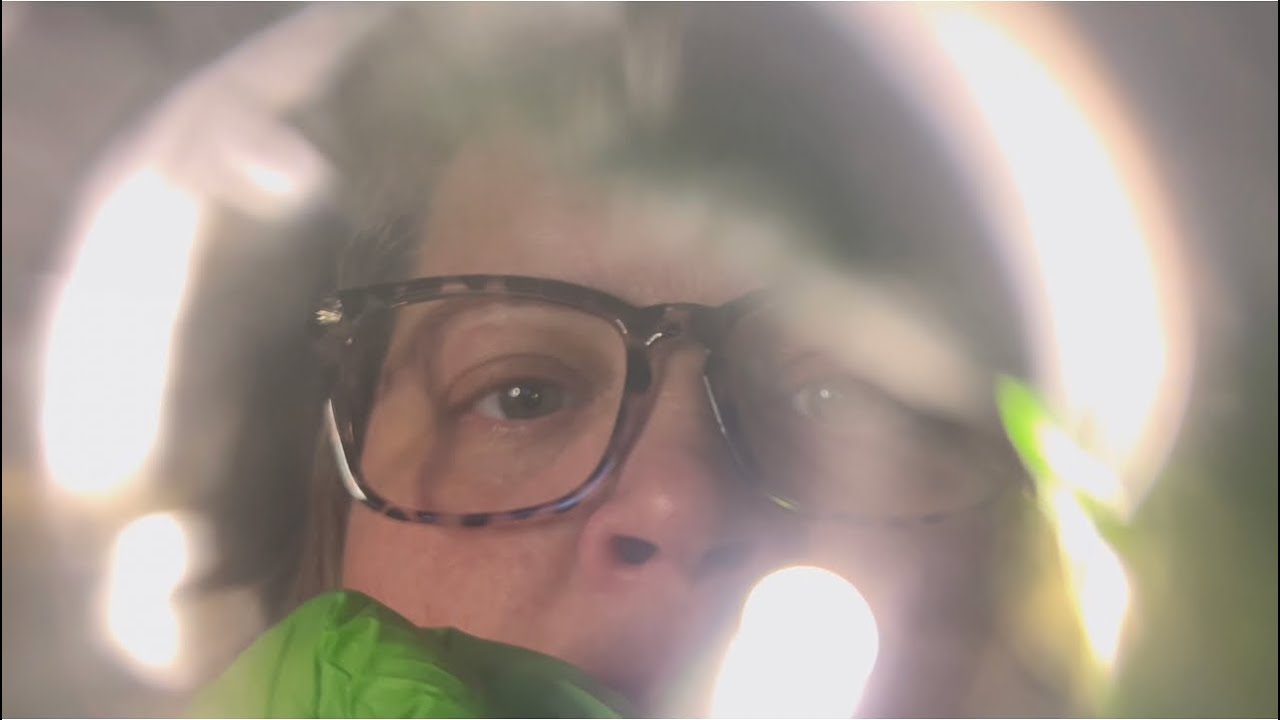 Getting Something Out of Your Eye & DETAILED Eye Exam to CURE Your Tingle Immunity | Camera Touching