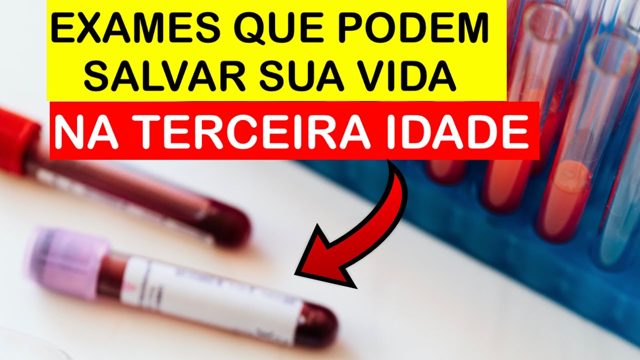 11 Exames Obrigat&oacute;rios na Terceira Idade (Check Up M&eacute;dico em Idosos)
