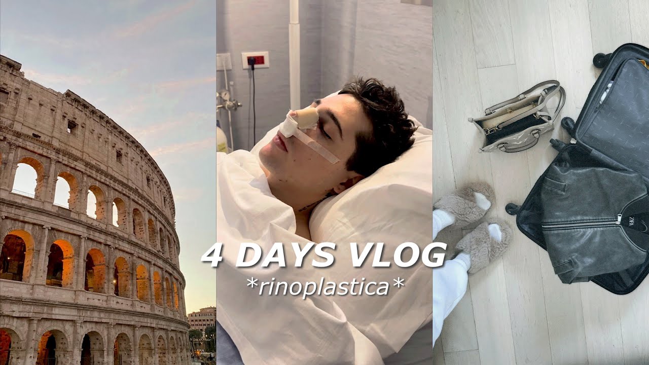 REGALO LA RINOPLASTICA AL MIO RAGAZZO: Roma, anestesia, post intervento & more | IF