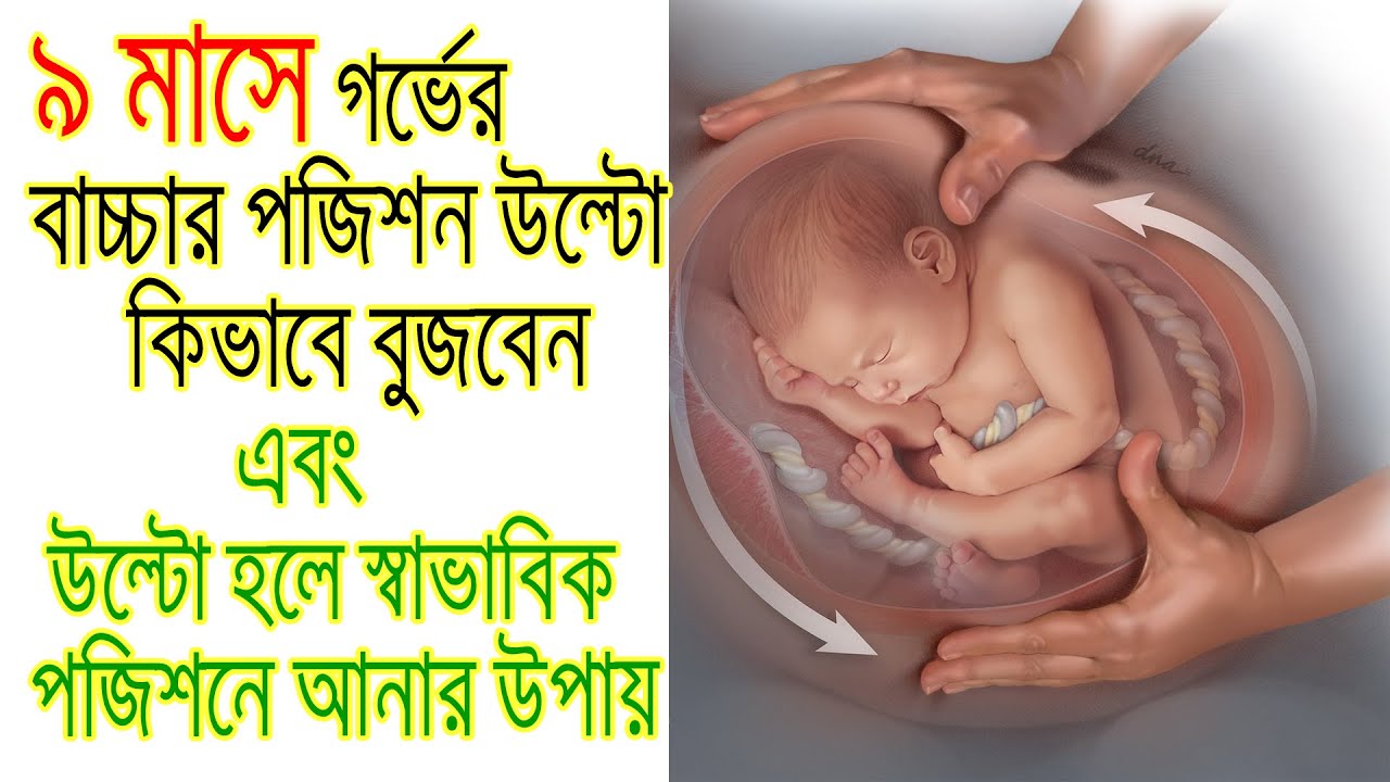 ৯ মাসে গর্ভের বাচ্চার পজিশন উল্টো কিভাবে বুজবেন,এবং উল্টো হলে স্বাভাবিক পজিশনে আনার উপায়।