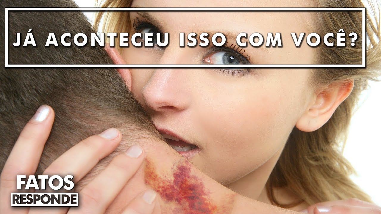 Como se livrar de qualquer chupão no pescoço (em tempo recorde)? - FATOS RESPONDE