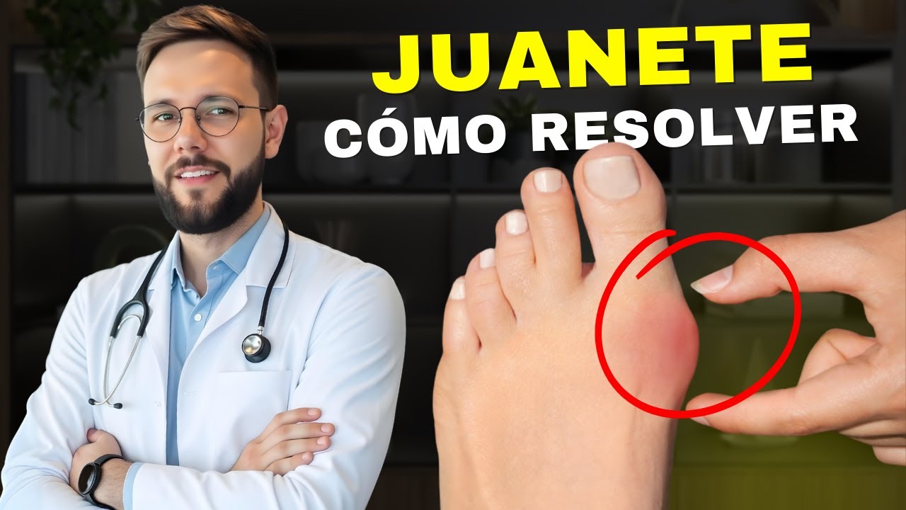 Juanete: Tratamiento Casero que Sí Funciona ✅