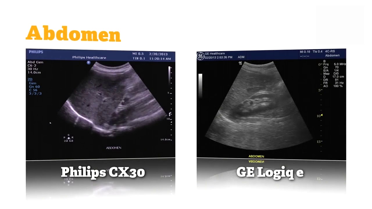 The Philips CX50 and CX30
