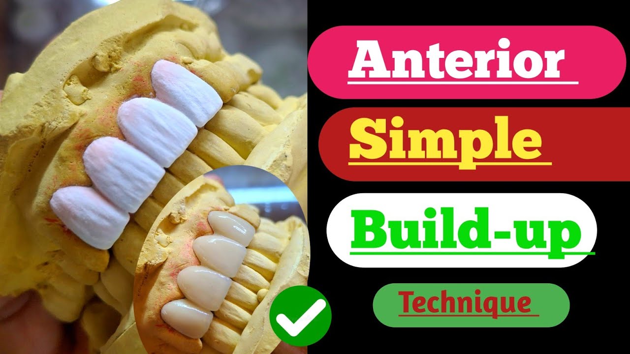 Anterior Simple Build up Technique| Ceramic Porcelain| Anatomy| Dental Technician| art'| Posterior|