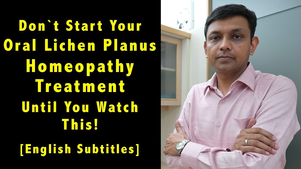 Don't Start Your Oral Mouth Lichen Planus Homeopathy Treatment Until You Watch This! Home Remedies