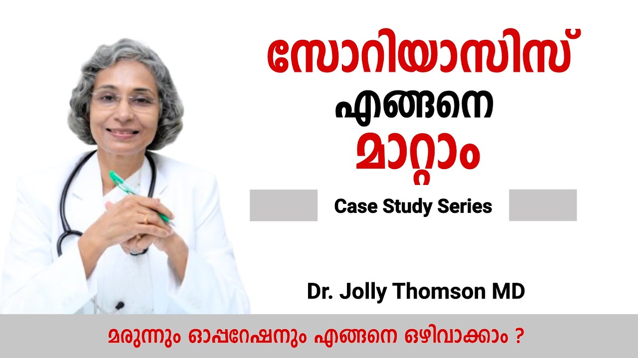 Psoriasis - [ Case Study ] സോറിയാസിസ് എങ്ങനെ മാറ്റാം