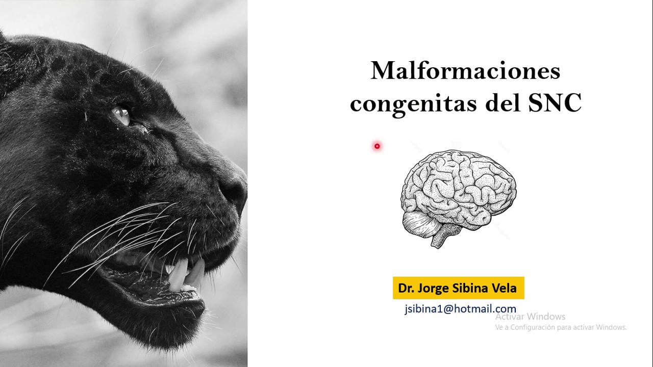Malformaciones congénitas del SNC